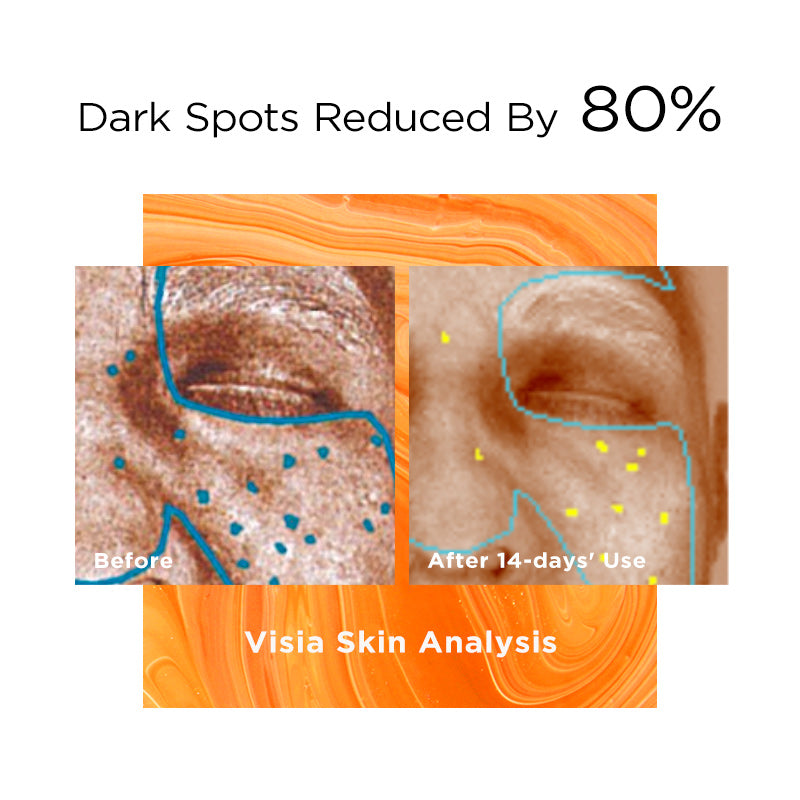 HYDRO BRIGHT TREATMENT 3